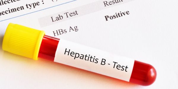 Testare gratuită hepatita B și C: Noi măsuri pentru depistare timpurie